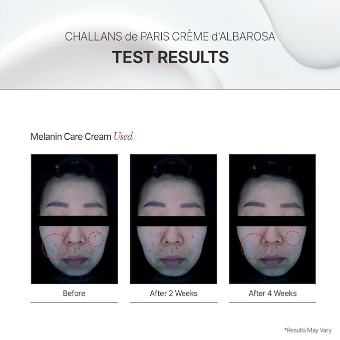 PARIS Crème d’Albarosa Excellence – Niacinamide Brightening Cream for Even Skin Tone | Dark Spot Care, Korean Skincare, 1.05 fl oz (30 ml) (DARK SPOT CORRECTOR, 1.05 fl oz)