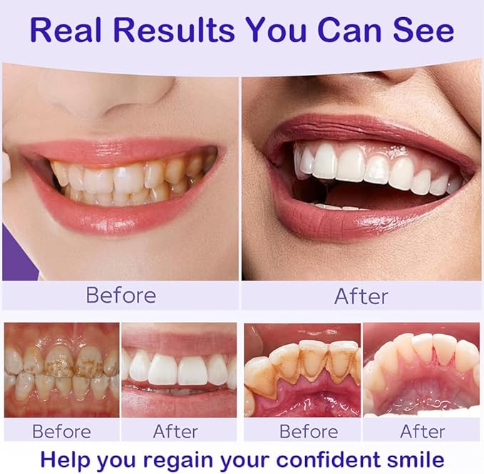 Teeth Whitening Powder, Remineralizing Hydroxyapatite Tooth Powder with Niacinamide, R5X Purple Color Corrector for Instant Brightening, Natural Teeth Whitening Formula, Mint Flavor, 50g (1)