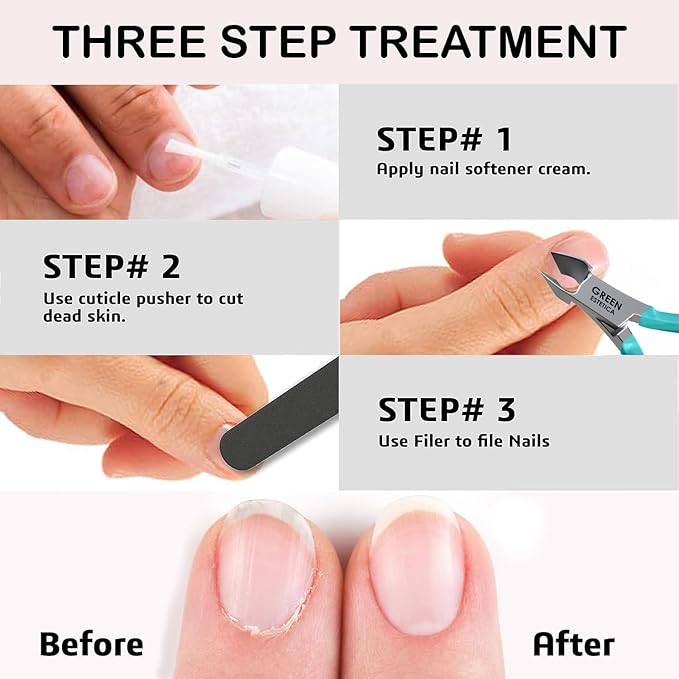 Professional Cuticle Trimmer Nail Cuticle Cutter Stainless Steel Cuticle Nippers with Sharp Blades of Cuticle Remover Clippers Manicure Tools Double Spring for Nail Care Pedicure Nail Tools (Cyan)