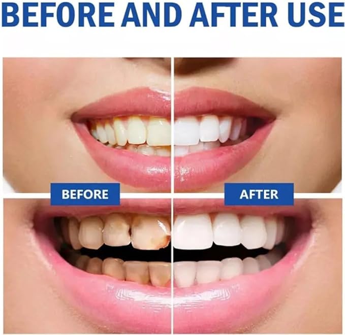 SP 10 Probiotic Whitening Toothpaste - Enhance Oral Health with SP 10 Toothpaste for Brighter, Healthier Teeth