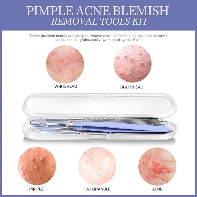 Teenitor 7 Pcs Pimple Popper Tool Kit, Surgical Grade Blackhead Remover Tools, Ingrown Hair Tweezers, Blackhead Extractor Pimple Extractor, Black Head Remover for Face