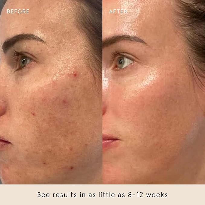 Barefaced Serum Duo - RetinAL & Overachiever to Improve Skin Firmness, Strengthen Skin Barrier, & Boost Retinoid Results