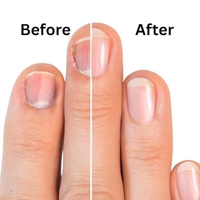 Dead Sea Cuticle & Nail Oil (5ML) | Strengthens, Moisturizes & Conditions with Sweet Almond, Olive, Jojoba, Castor, Argan Oils, Lemon Essential Oil, Vitamin E & Dead Sea Salt