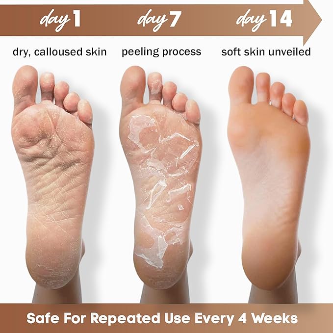 Foot Peeling Mask – Lavender Exfoliating Treatment Booties for Callus Removal & Renewal of Dry, Cracked Feet – Dermatologist-Inspired Moisturizing Spa Therapy for Men & Women (Shea Butter 2 Pairs)