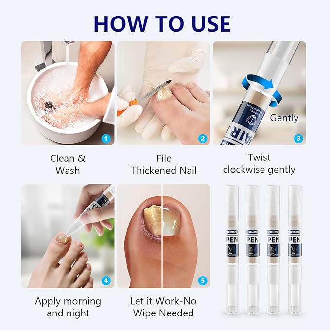 iKeener Toe Nail Fungus Treatment Pen - 25% Undecylenic Acid, Tea Tree Oil Extra Strength for Toenails and Fingernails, 0.4 Fl Oz (Pack of 4)