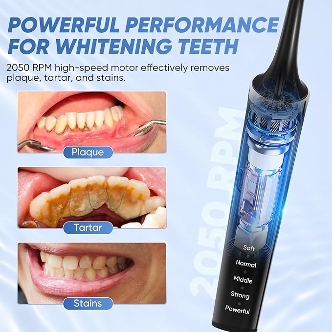 Saker Tooth Polisher, 2 Set Replacement Polishing Brush Heads(12pcs) Included, Rechargeable Tooth Polishing Kit, Dental Teeth Polisher with LED Light, 5 Speed Modes, Waterproof