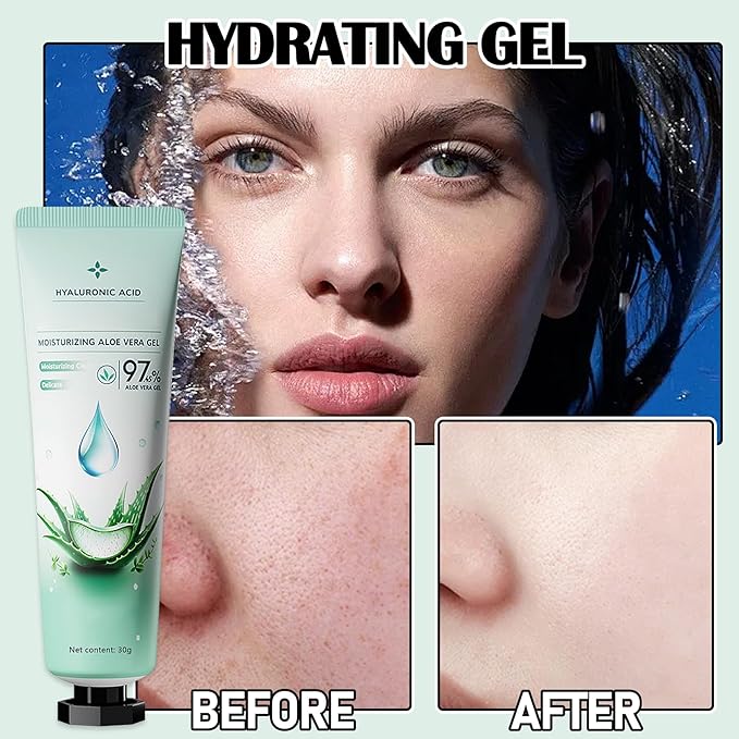 8Pcs Organic Aloe Vera Gel for After Sun Skin Care,Natural Moisturizing Aloe Vera Gel for Face & Body,Easy to Portable Face Moisturizer,Travel Size Pure Vera Aloe Gel for all Skin Types E