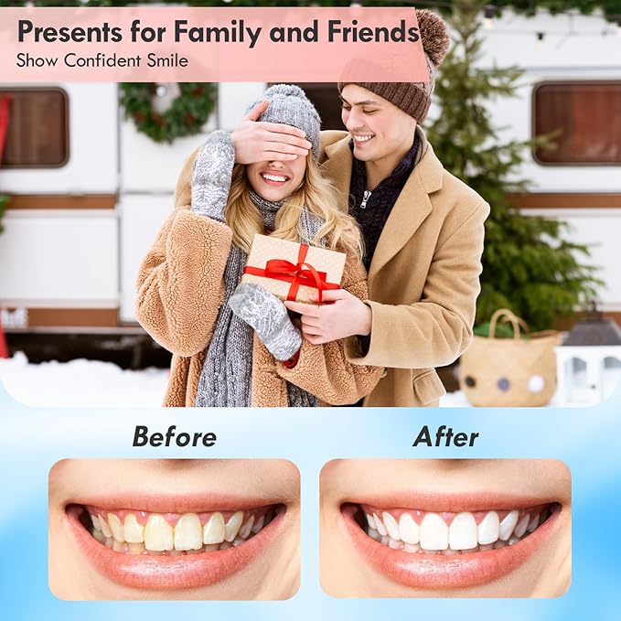 Tooth Polisher, Rechargeable Teeth Polisher for Daily Cleaning, Whitening and Polishing, Electric Dental Teeth Polishing with LED Light, 5 Brush Heads, 5 Speed Modes, Waterproof