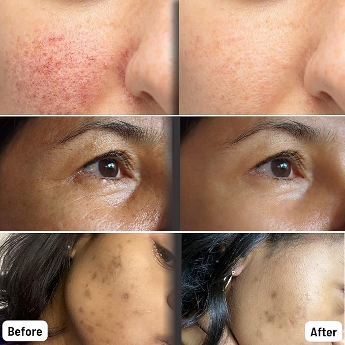 ORGAID Organic Sheet Mask | Made in USA (Assorted Multi-pack, pack of 6)