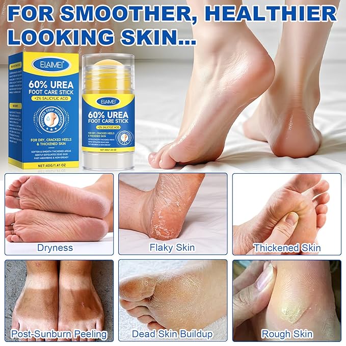60% Urea with 2% Salicylic Acid Urea Foot Care Stick, Heel Stick for Cracked Feet, Foot Care Cream Moisturizer for Dry Cracked Feet, Knees, Elbows, Hands, Foot Lotion Stick -1.41oz