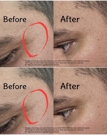 New Facial Serum for Sensitive Skin Vitamin C Hyaluronic Acid & Niacinamide Hydrating Anti-Aging Formula 1 fl oz (30 ml)