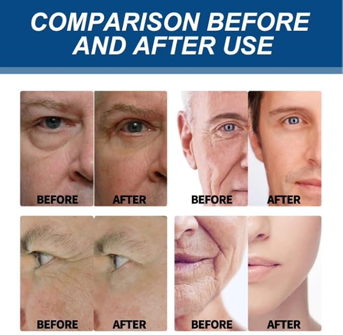 6-in-1 Face Cream for Men, Anti-Aging Moisturizer with Collagen, Hyaluronic Acid and Shea Butter, Reduces Wrinkles, Dark Circles and Puffiness, Men's Formula Daily Care 1.76 fl oz (1)