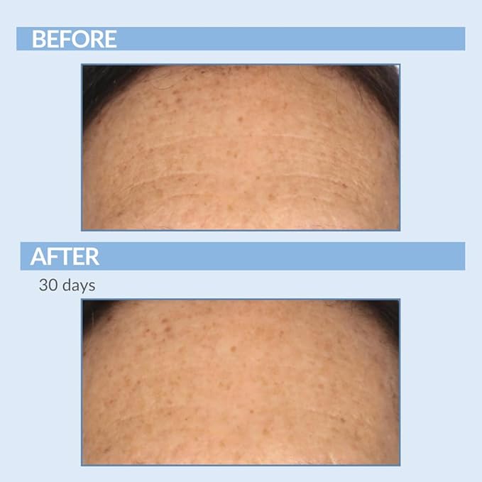 Serious Skincare Vitamin A Force XR Retinol Face Serum Concentrate, Micro Exfoliate & Resurface for Radiant Skin, for Lines, Wrinkles, Pore Minimizer, Anti-Aging 1 Oz. (Pack of 2)