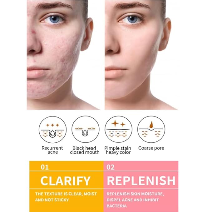 Turmeric Face Cream with Niacinamide Hyaluronic Acid Vitamin C and Jojoba Oil Brightening Moisturizing Anti Wrinkle Cream for Acne Spots Repair and Firm Skin (2)