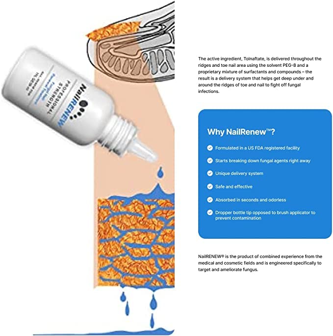 NailRENEW Antifungal - Professional Strength, Compliant Fungus Treatment for Toe Fungus, Discolored or Brittle Nails (1 Bottle) (3)