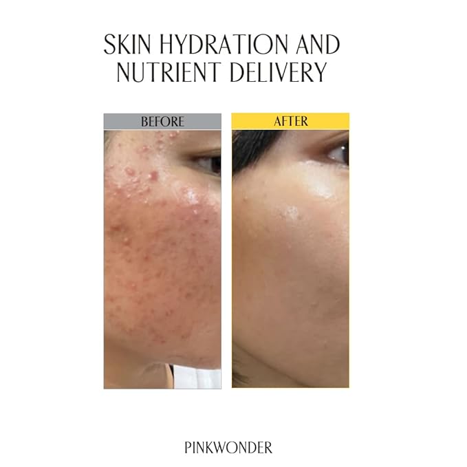 PINKWONDER USDA Organic 100% pure Jojoba oil toner | Hydrating Essence for Skincare | Korean Facial Toner with Jojoba Oil & Wild Strawberry Leaf Extract (6.76oz)