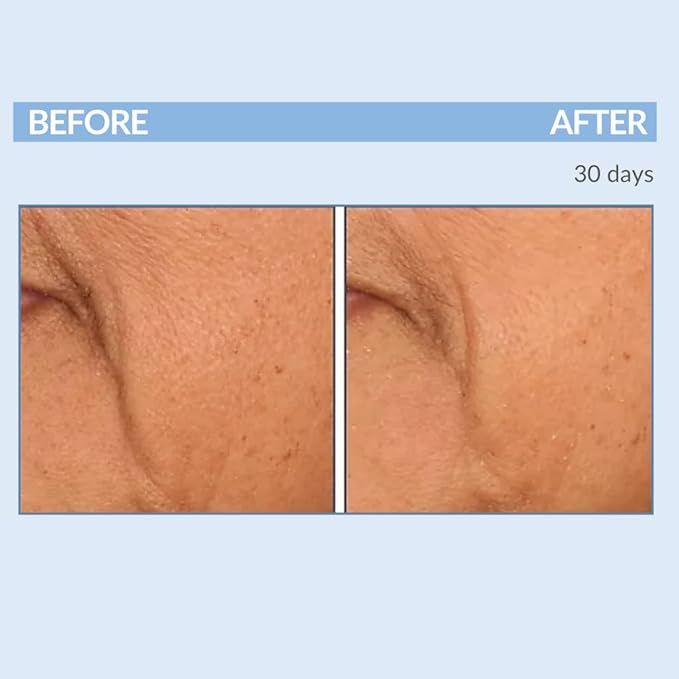 Serious Skincare Vitamin A Force XR Retinol Face Serum Concentrate, Micro Exfoliate & Resurface for Radiant Skin, for Lines, Wrinkles, Pore Minimizer, Anti-Aging 1 Oz. (Pack of 2)