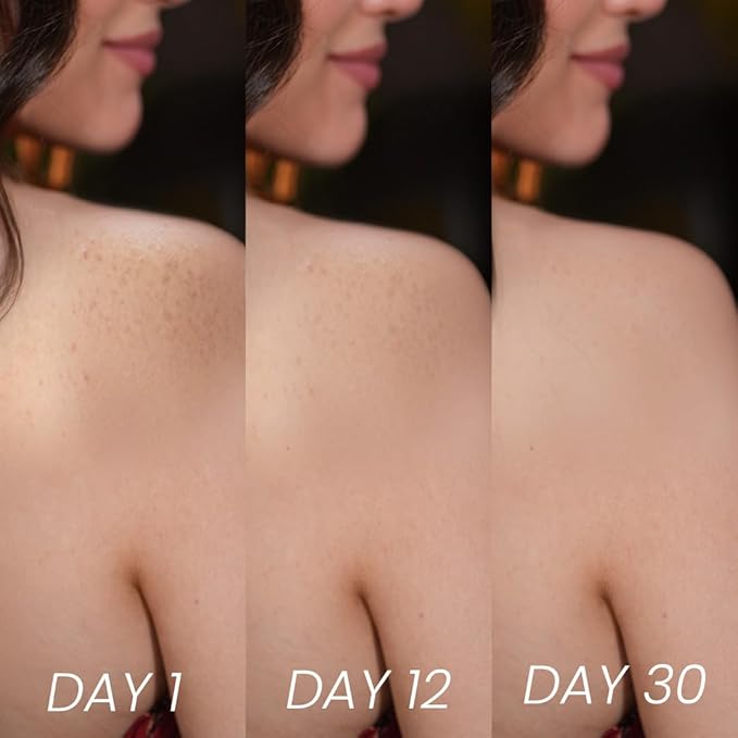 Scrub Soap with Salicylic Acid & Neem – Exfoliating Body & Face Soap – Enriched with Niacinamide, Tea Tree Extract, Neem, Salicylic Acid Pack of 3 (110g/3.88Oz each)