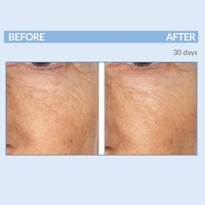 Serious Skincare Vitamin A Force XR Retinol Face Serum Concentrate, Micro Exfoliate & Resurface for Radiant Skin, for Lines, Wrinkles, Pore Minimizer, Anti-Aging 1 Oz. (Pack of 2)