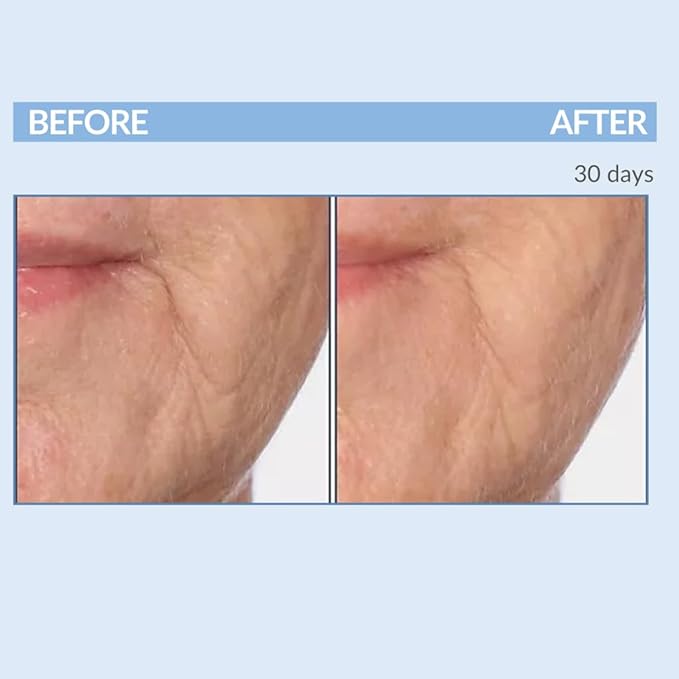 Serious Skincare Vitamin A Force XR Retinol Face Serum Concentrate, Micro Exfoliate & Resurface for Radiant Skin, for Lines, Wrinkles, Pore Minimizer, Anti-Aging 1 Oz. (Pack of 2)