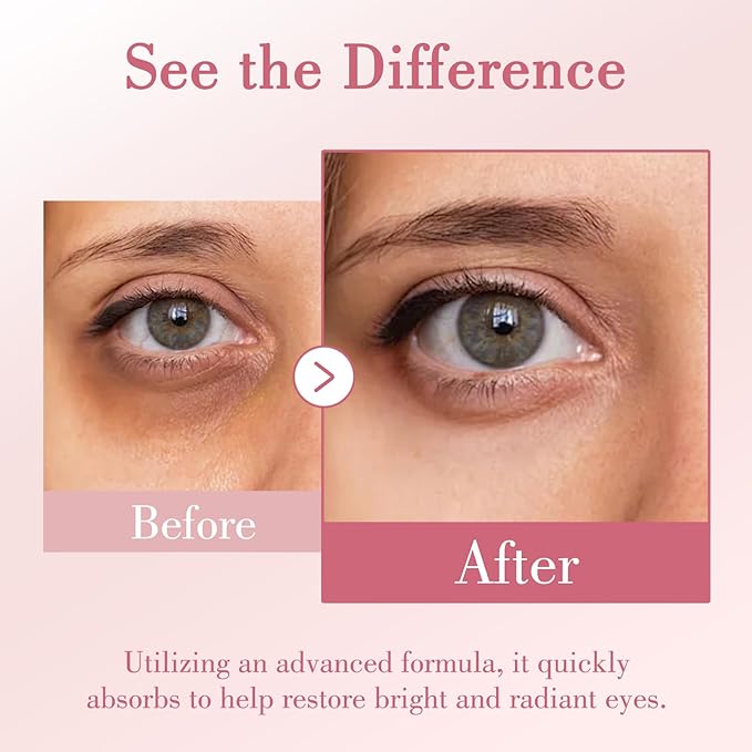 Eye Cream, Under Eye Cream with Caffeine + Hyaluronic Acid + Vitamin E, for Puffiness, Wrinkles & Fine Lines, Daily Cream for Moisturizing and Hydrating, Skin Care for Face, 1.05 Fl Oz