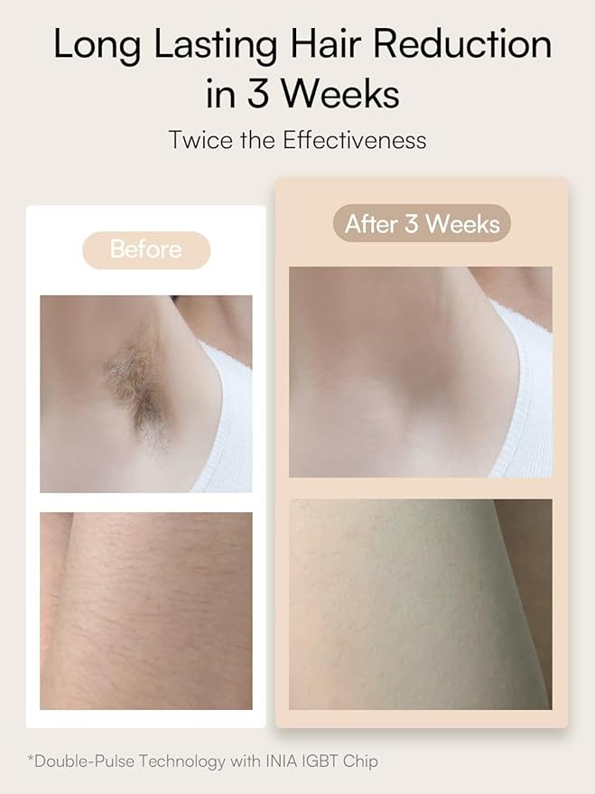 Laser Hair Removal for Women and Men, IPL Hair Removal Device with Ice-Cooling, Double Effectiveness & 5 Flashes per Second for Long-Lasting and Nearly Painless Results