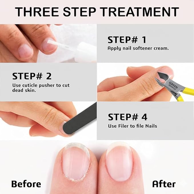 Professional Cuticle Trimmer Nail Cuticle Cutter Stainless Steel Cuticle Nippers with Sharp Blades of Cuticle Remover Clippers Manicure Tools Double Spring for Nail Care Pedicure Nail Tools (Yellow)