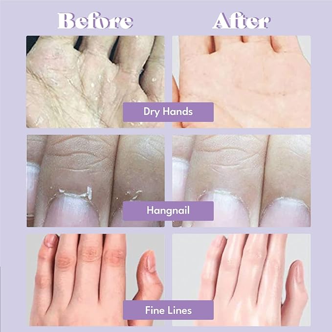 Catherine Muller Floral Hand Mask 1 Pair, Moisturizing Gloves for Dry Hands with Elder Flower & CICA, Repairing and Nourishing Hand Care Treatment for Cracked, Rough, and Dry Skin, Stocking Stuffer