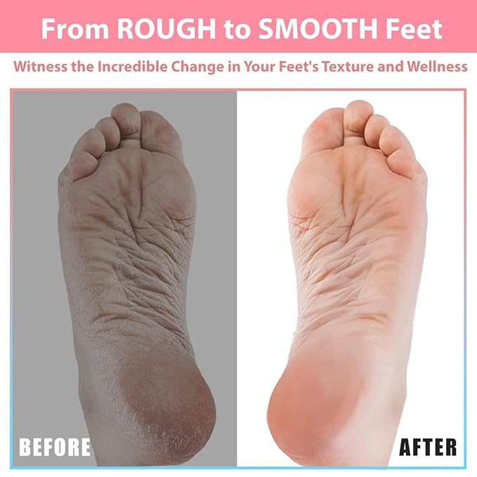 Efforest Shower Foot Scrubber Mat with Pumice Stone - Cleans, Smooths & Removes Dead Skin on Foot Without Bending, Foot Callus Remover with Non-Slip Suction Cups (Pink)