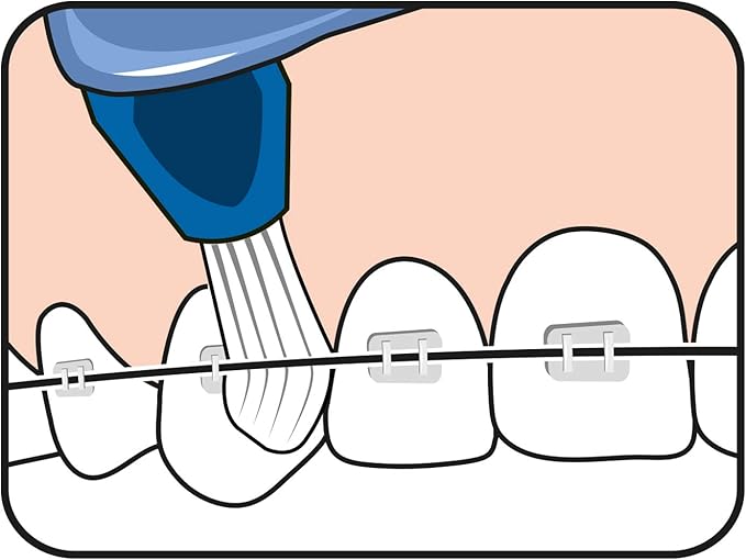 TePe Interspace Angled Medium Toothbrush for Braces with Single-End Tuft and Removable Head, 12 Pack