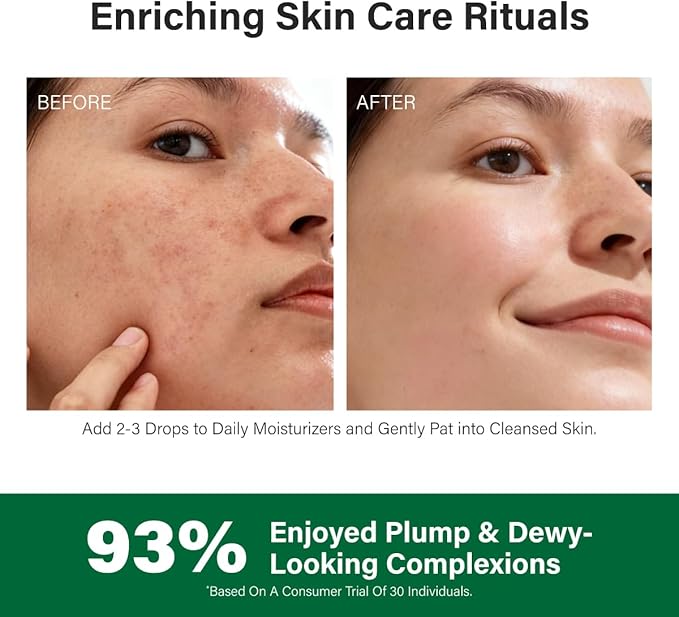 KUKKA Helichrysum Essential Oils - 4 Fl Oz - for Hair, Skin, Diffuser, Aromatherapy & DIY Soap Making Scent