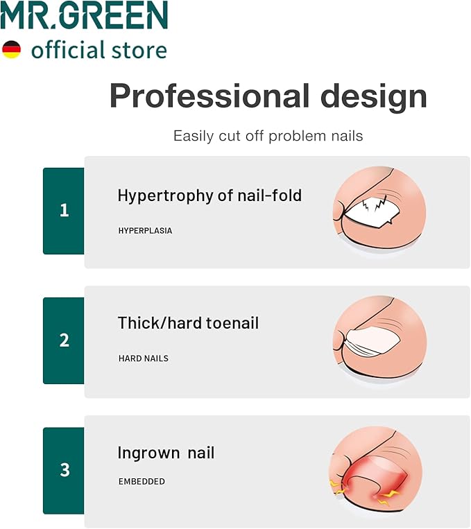 MR.GREEN Toenail Clippers Stainless Steel Ingrown Nail Cutter Thick and Hard Nails Pedicure Manicure Tools (Orange+Nail Remover)