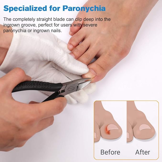 FERYES Straight Blade Toenail Clippers with Toenail Lifter and Fork - Toe Nail Clipper for Thick Toenails - 2 in 1 Ingrown Toenail Tools Kit