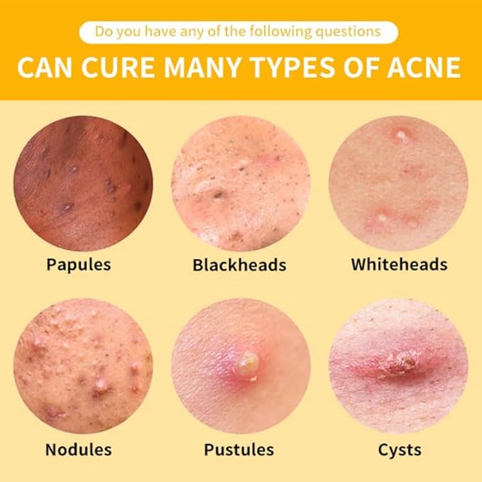 Turmeric Face Cream with Niacinamide Hyaluronic Acid Vitamin C and Jojoba Oil Brightening Moisturizing Anti Wrinkle Cream for Acne Spots Repair and Firm Skin (1)