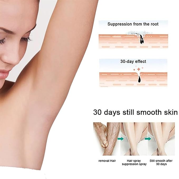 Removedor De Vello En Spray, Hair Removal Spray, Moisturizing & Gentle for Men and Women (1pcs)