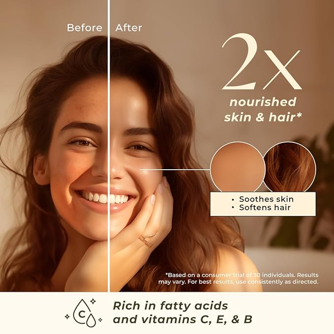 Gya Labs Rosehip Carrier Oil - 1 Fl Oz - for Hair, Skin, Face, Scalp & Body Massage