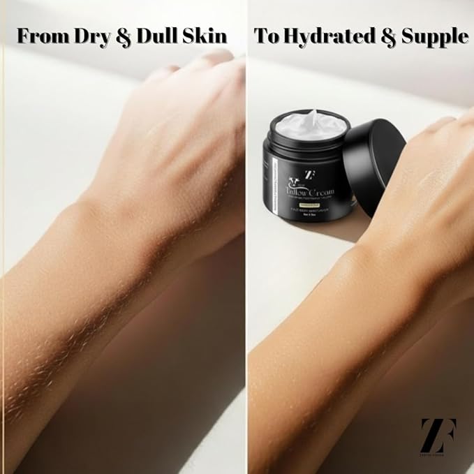 ZF 100% Grass Fed Beef Tallow for Skin Care - Face + Body - Natural Organic Lotion - Whipped Moisturizer for Sensitive Skin 4 FL. oz. (Unscented)