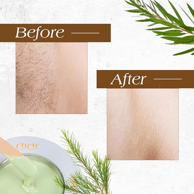 GiGi Tea Tree Crème Wax - Soothing Hair Removal Wax for Sensitive Skin, Soft Wax for Face & Body, Calming Formula with Tea Tree Oil, 14 oz