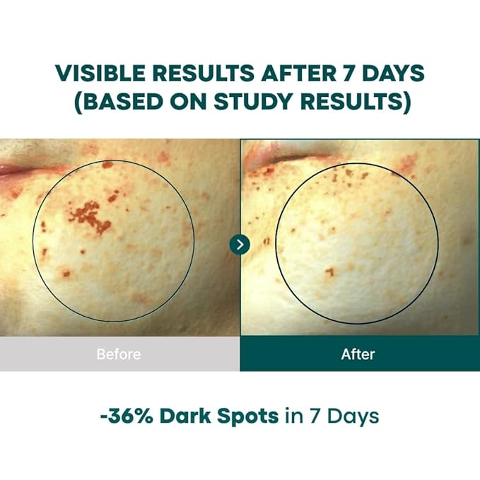 Vita C Capsule Double Shot Ampoule Kit-Korean Serum for Dark Spots Uneven Skin Tone, Pure Vita C 3% + Retinol 300 IU + Niacinamide, K-beauty, 10ml, 0.33 fl. oz.