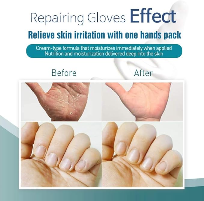 Epielle Intensive Repairing Hand Mask 6 Pairs, Deep Moisturizing Gloves for Dry, Cracked Hands, Self Care Gifts for Women, Spa Kit, Stocking Stuffers, Thanksgiving Essentials