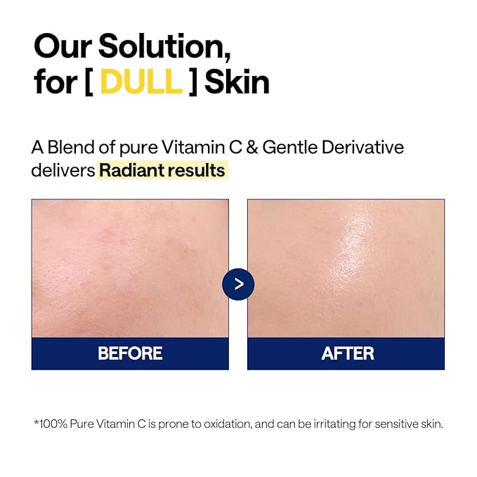 MEDIHEAL Vitamin C Brightening Serum (1.35 fl oz, 1 Pack) - Tone-Texture-Glow Care, Manage Skin with Vitamin C, Niacinamide, Hyaluronic Acid