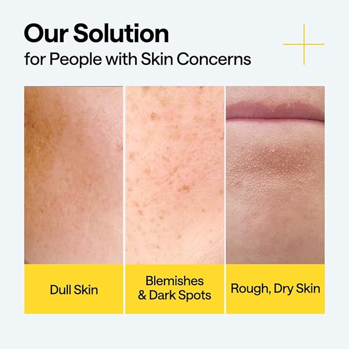 MEDIHEAL Vitamin C Brightening Serum (1.35 fl oz, 1 Pack) - Tone-Texture-Glow Care, Manage Skin with Vitamin C, Niacinamide, Hyaluronic Acid