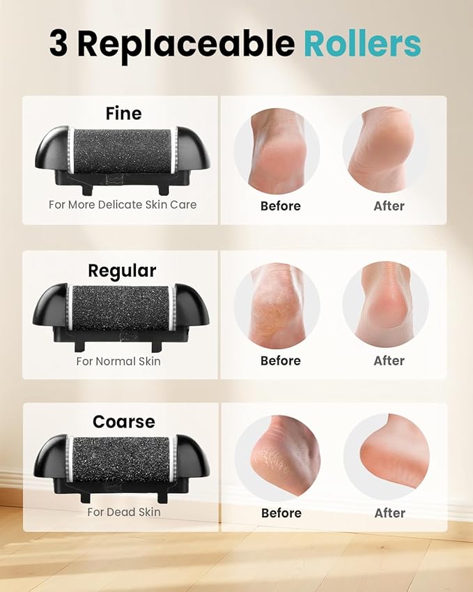 Electric Foot Callus Remover with 10000 RPM Motor and 3-Speed Settings, Foot Scraper Kit for Women’s Home Pedicure Foot File with Type-C Charging