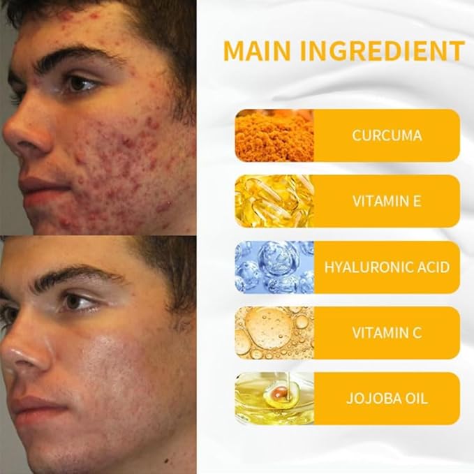 Turmeric Face Cream with Niacinamide Hyaluronic Acid Vitamin C and Jojoba Oil Brightening Moisturizing Anti Wrinkle Cream for Acne Spots Repair and Firm Skin (2)