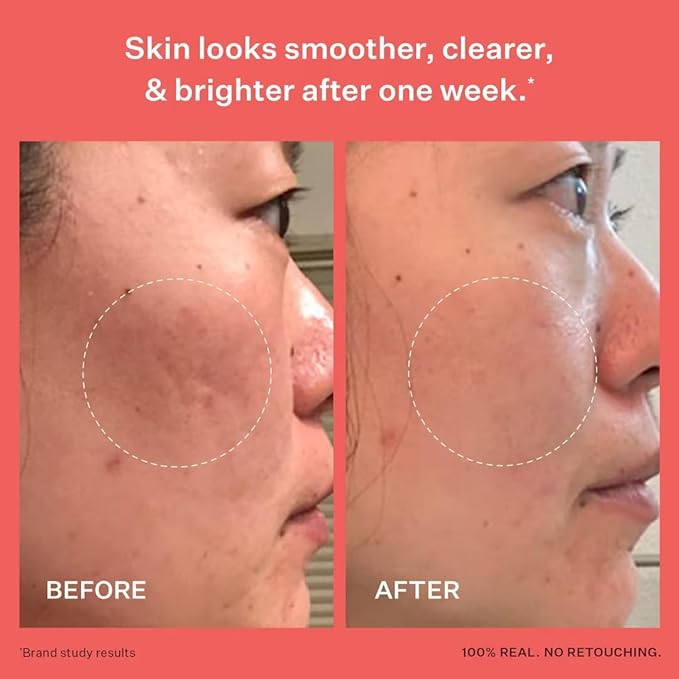 Peach & Lily - Glass Skin Refining Serum for Face (1.35 ounces) - Hyaluronic Acid Niacinamide Serum - Sensitive Skin - Vitamin B3, Peach & Yam, Peptides - Self Care, Vegan, Cruelty Free, Korean Beauty