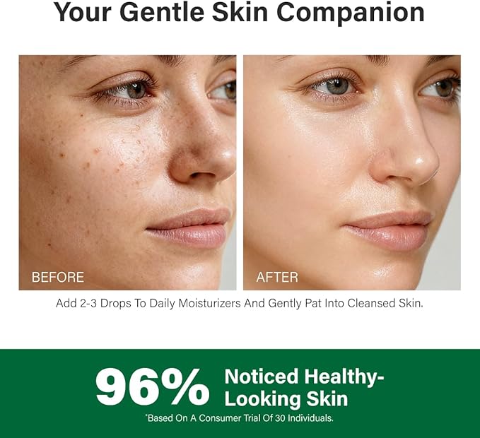 KUKKA Rose Geranium Essential Oils - 4 Fl Oz - for Hair, Skin, Diffuser, Aromatherapy & DIY Soap Making Scent