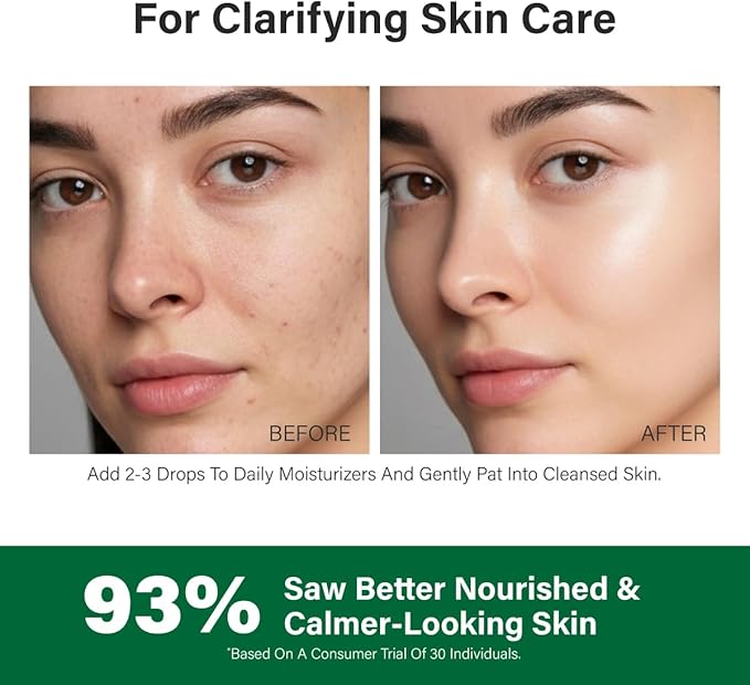 KUKKA Tea Tree Essential Oils - 4 Fl Oz - for Hair, Skin, Diffuser, Aromatherapy & DIY Soap Making Scent