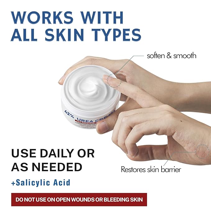 OUKEYA Urea Cream 42% plus Salicylic Acid 2% Net 5.29 Oz for Dry Cracked Feet,Heels,Knees,Elbows,Hands Repair Treatment Moisturizes and Removes Corns,Calluses,Dead Skin,and Softens Toenails Pack of 4
