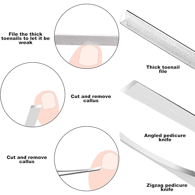 ZIZZON 7 Pcs Ingrown Toenail File and Lifters Set, Stainless Steel Ingrown Toenail Removal Kit, Under Nail Cleaner Pedicure Tools