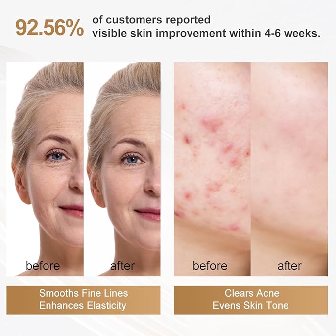 Aphrona FDA cleared LED Facial Skin Care Mask -Blue & Red Light Treatment Photon Mask (Pearl)